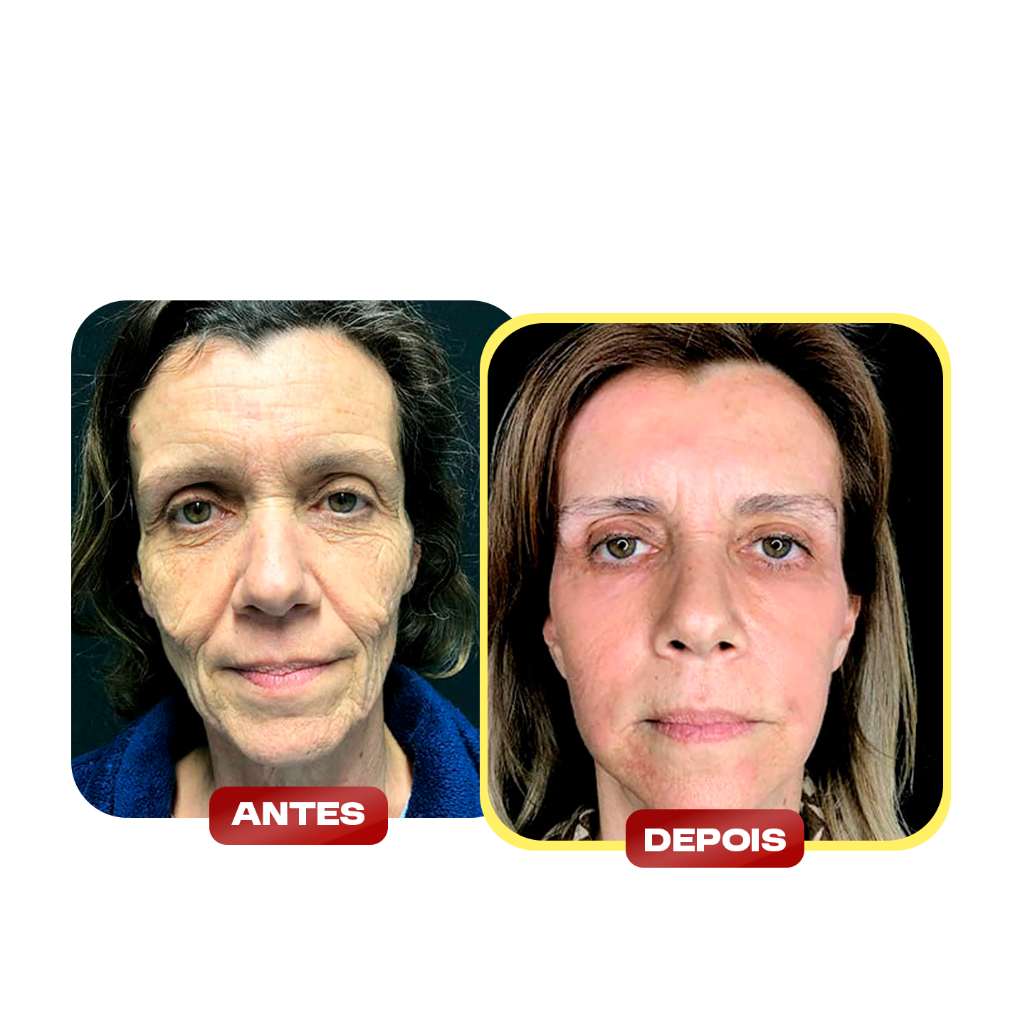 ANTES E DEPOIS 9